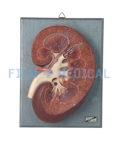 Kidney Model 